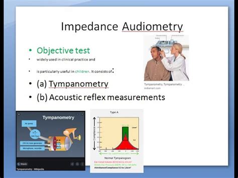 how to read a tympanogram|Understanding Tympanometry: A Comprehensive Guide.